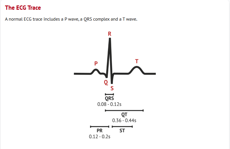 Normal ECG